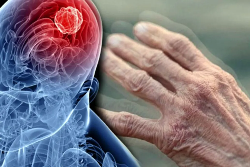 Tarım İlaçları Parkinson Riskini Artırıyor: Uzmanlardan Önemli Uyarılar